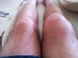 knee